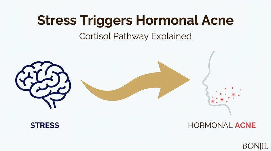 Stress and hormonal acne connection showing the cortisol pathway from stress to facial breakouts