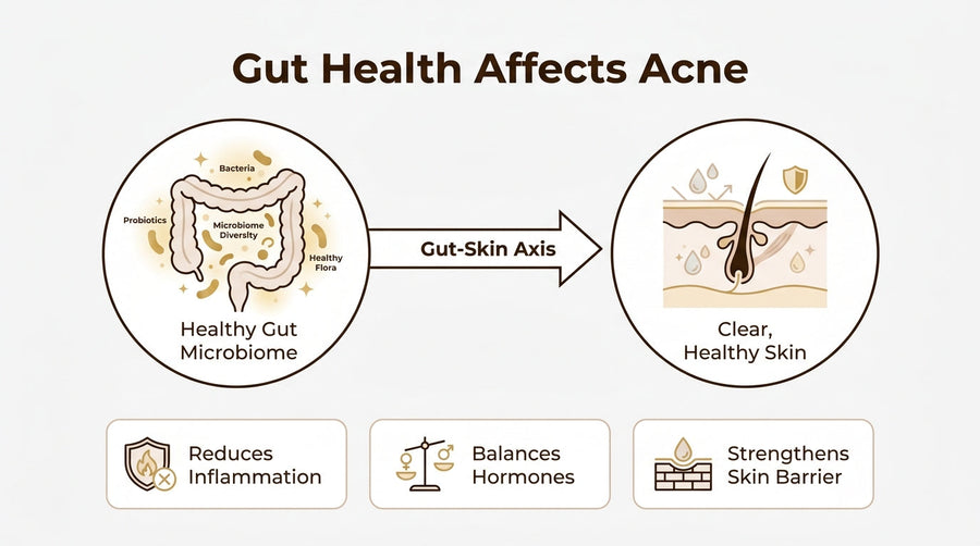 Infographic showing the gut-skin axis connecting a healthy gut microbiome to clear skin