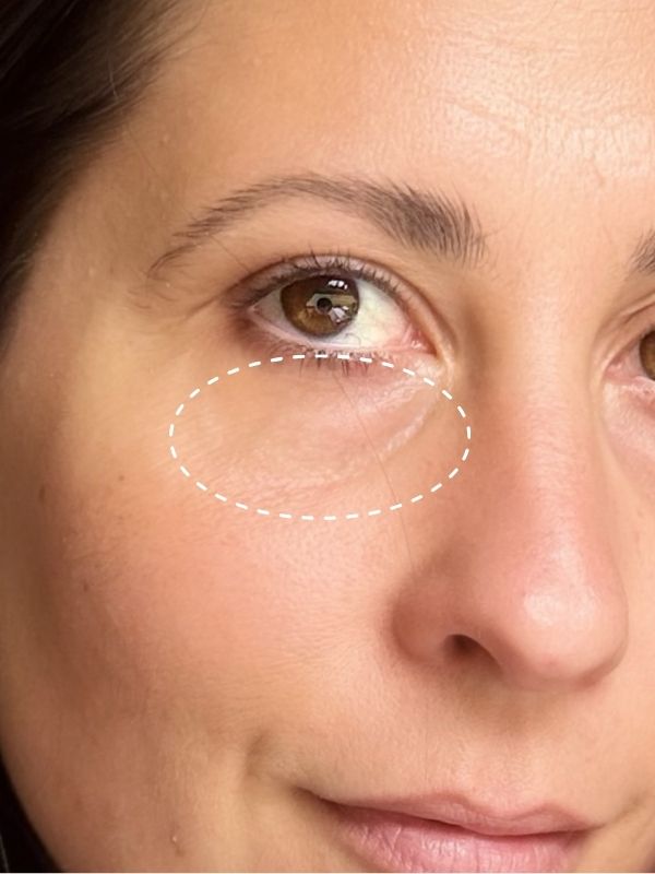 After: Before and after 7 days of The Signature Caviar Eye Cream