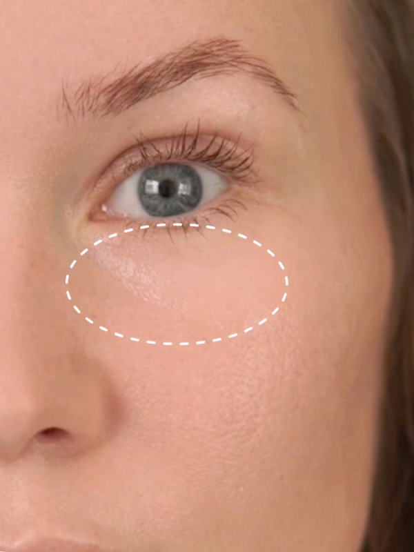After: Before and after 14 days of The Signature Caviar Eye Cream