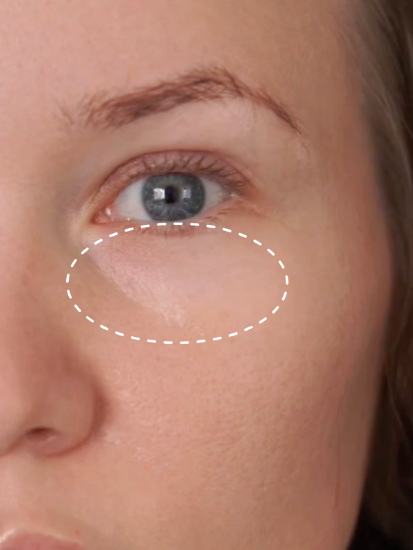 Before: Before and after 14 days of The Signature Caviar Eye Cream