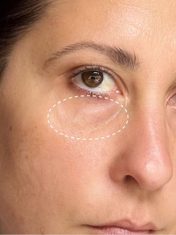 Before: Before and after 7 days of The Signature Caviar Eye Cream